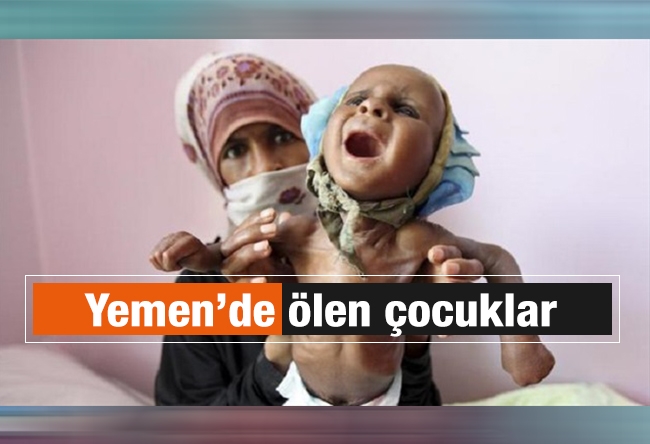 Özlem Albayrak : Yemen’de ölen çocuklar