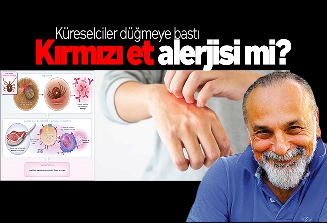 Haşmet Babaoğlu : Alerjisi de geldi!